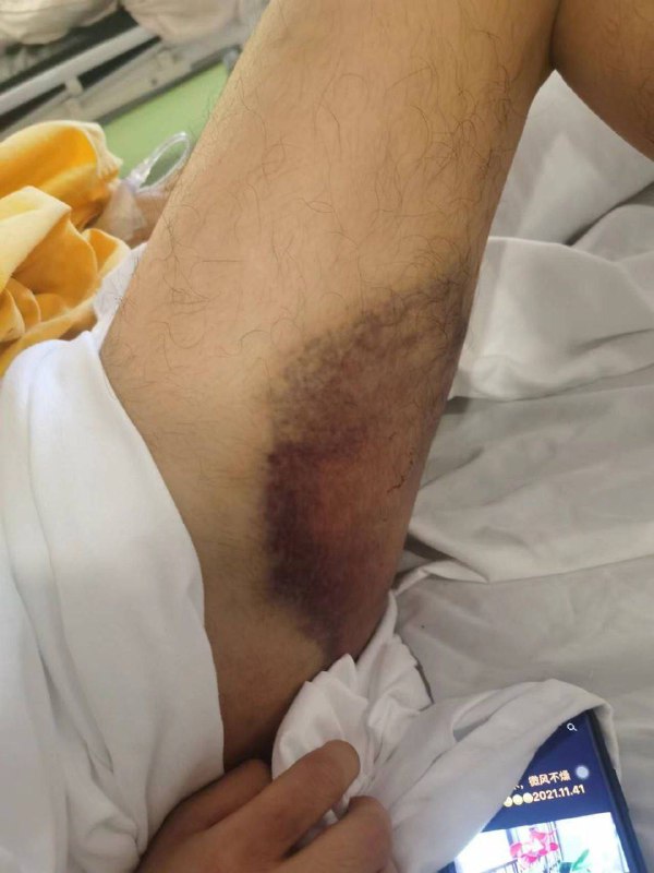 揭开环亚园区代理阿靓的黑幕 揭开环亚园区代理阿靓的黑幕