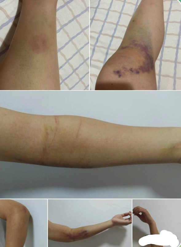 关于天涛集团在柬埔寨西港的管理与员工待遇问题 关于天涛集团在柬埔寨西港的管理与员工待遇问题