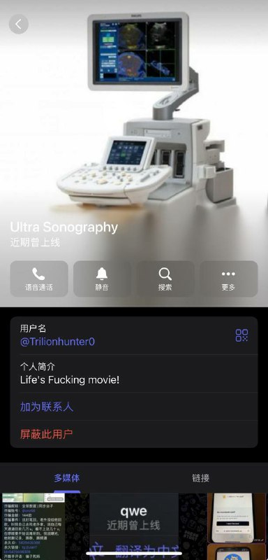 防范诈骗:UItra Sonography案例分析 防范诈骗:UItra Sonography案例分析